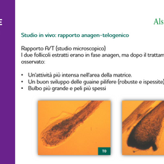A29 Lozione Anticaduta Special