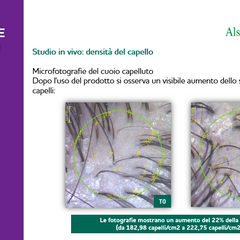 A29 Lozione Anticaduta Special
