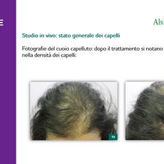 A29 Lozione Anticaduta Special